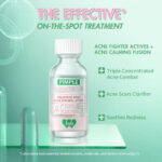 BNB barenbliss Pimple Warrior! Salicylic Acid Acne Spot Treatment Drying Lotion [Inflammation Reliever] 35g & 15g hanya RM19.90 di Shopee