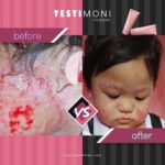 SNOWHITEE Treatment Lotion Susu Unta Merawat masalah kulit  eczema sel kulit mati hanya RM35.00 di Shopee