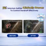 Selsun Blue Pro Extra Strength Anti-Dandruff Shampoo 120ml [Anti-Dandruff/ Superior Moisturizing/ Soothe Itchy Scalp] hanya RM26.01 di Shopee